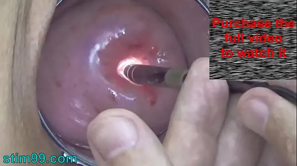 XXX Endoscope Camera inside Cervix Cam into Pussy Uterus mega Movies