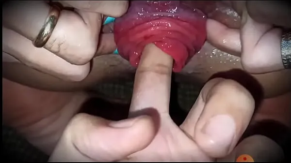 XXX Prolapse finger megafilmer