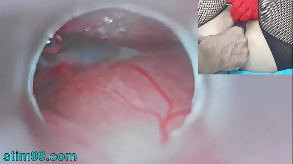 XXX Uncensored Japanese Insemination with Cum into Uterus and Endoscope Camera by Cervix to watch inside womb mega Movies